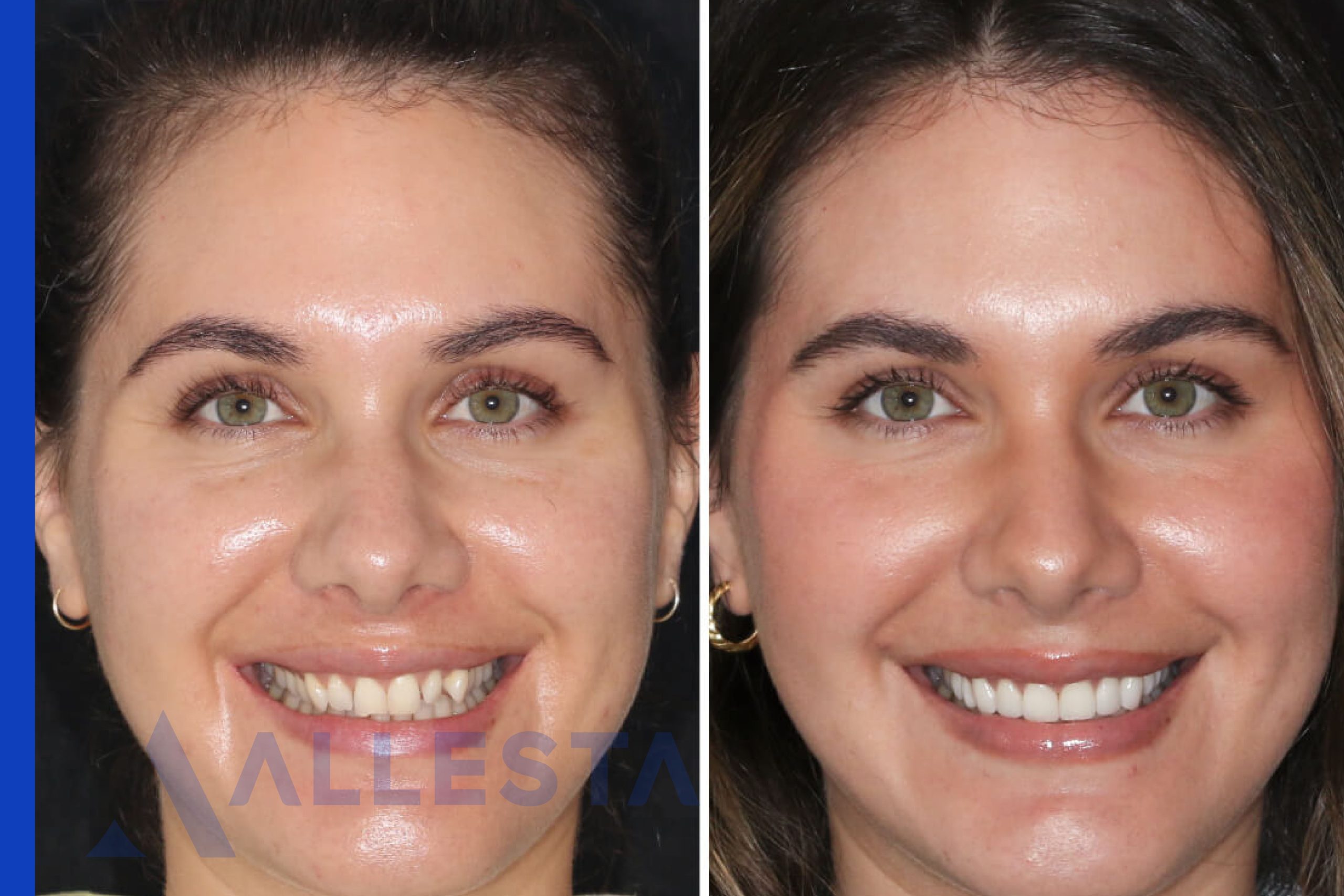 Before and after1-01