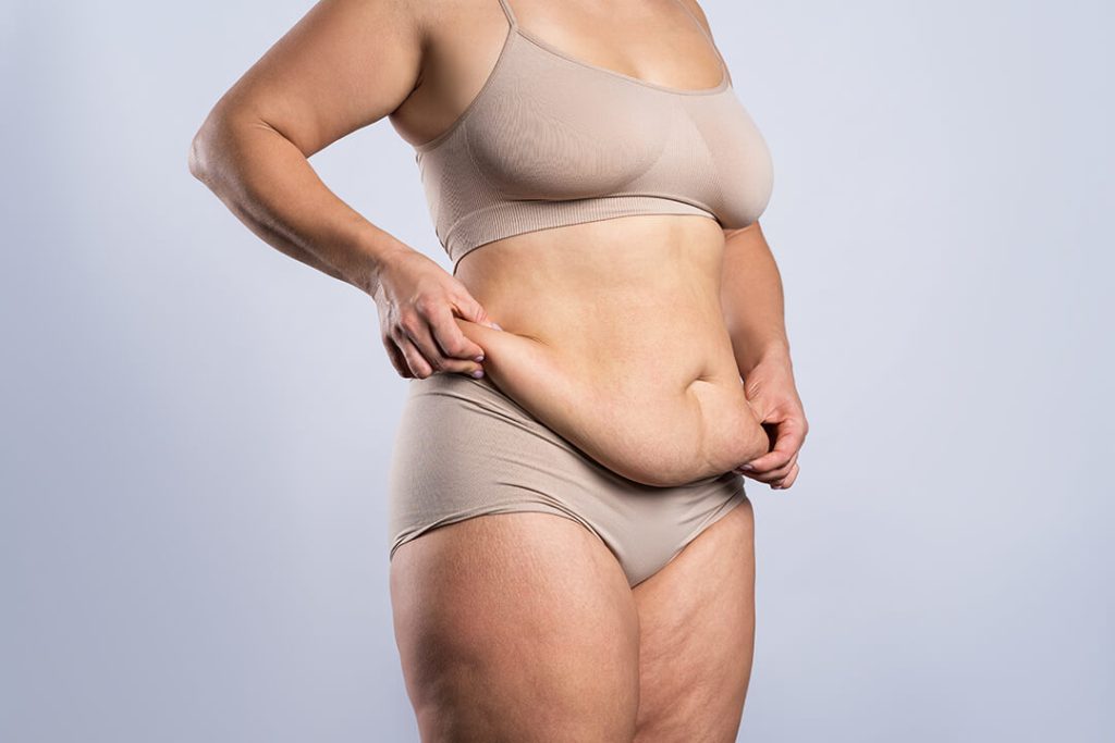 360 Lipo: Procedure, Benefits, & Cost in 2025