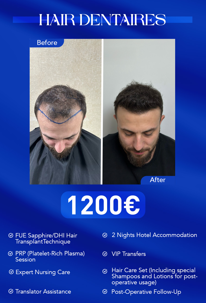 paket1 türkçe