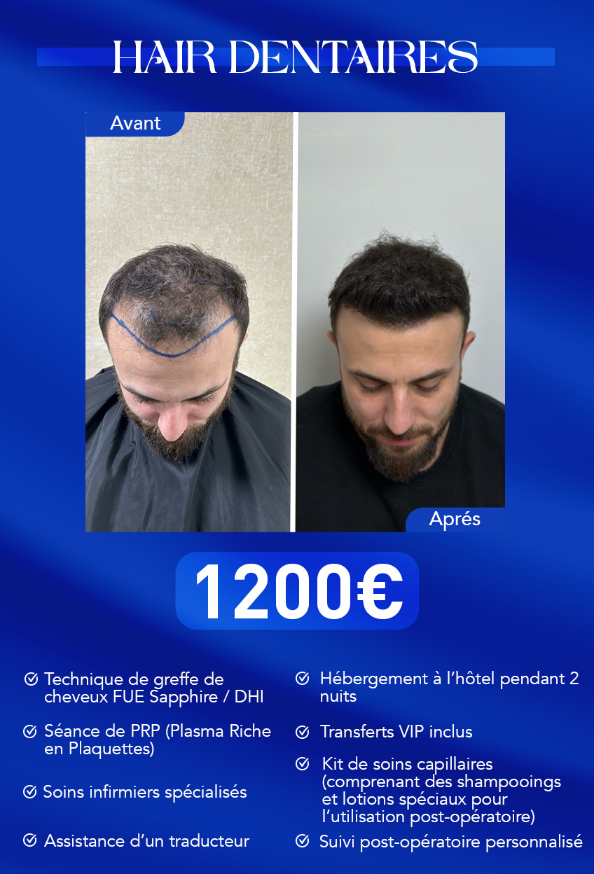 paket1fransızca